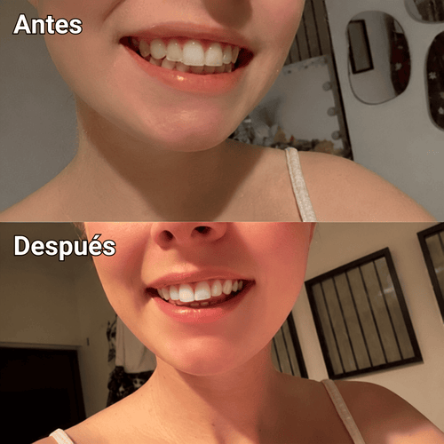 Amara™ | Sérum Blanqueador Dental