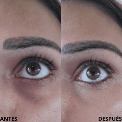 AMARA® - Corrector CC para Ojeras